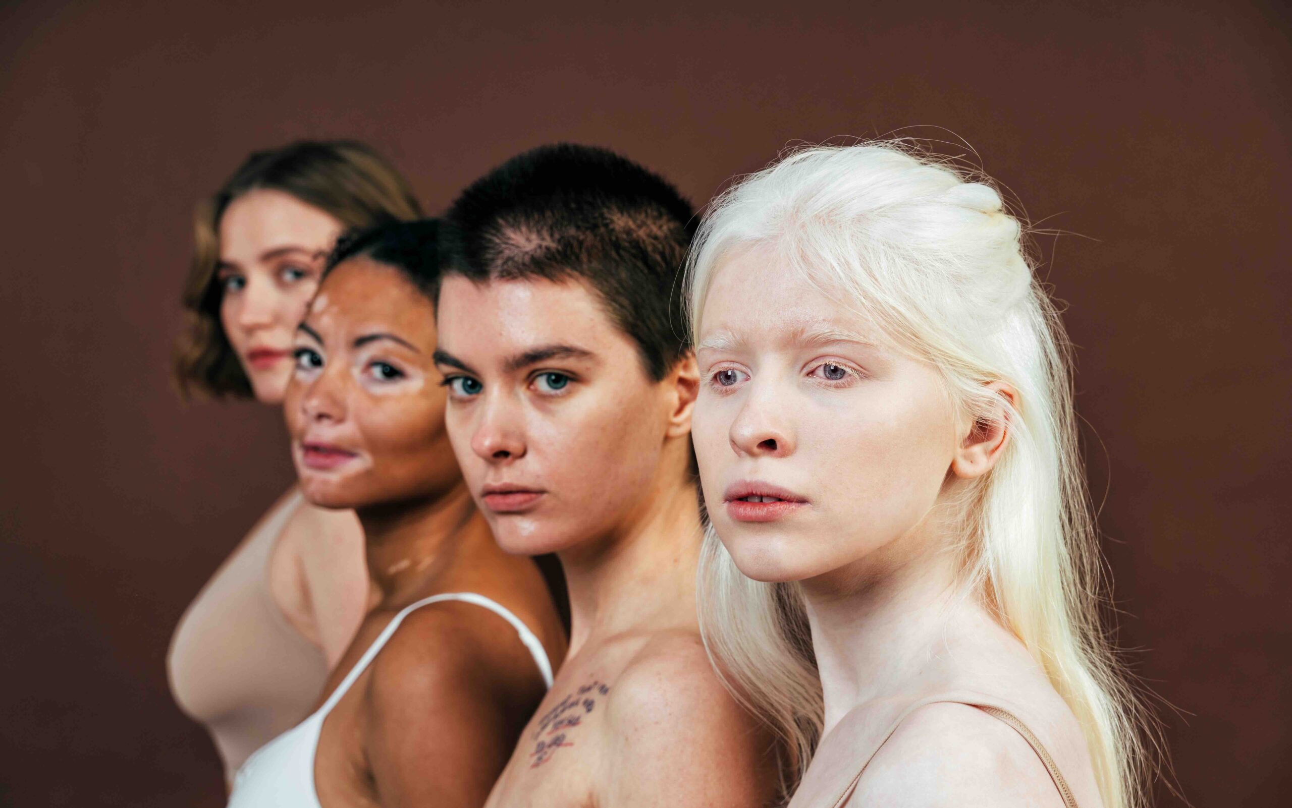 Group of multiethnic women with different kind of skin posing together in studio. Concept about body positivity and self acceptance